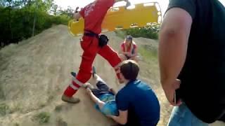 В Одессе вело экстремал получил открытую травму колена +18