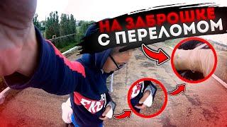 НА ЗАБРОШКЕ С ПЕРЕЛОМОМ // МЕСТНЫЙ ЛОСЬ
