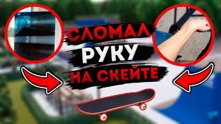 СЛОМАЛ РУКУ НА СКЕЙТЕ // МЕСТНЫЙ ЛОСЬ