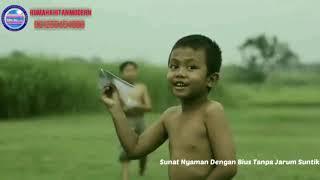 Sunat Paling Enak Itu Di Rumah Khitan Modern Pangkalan Bun
