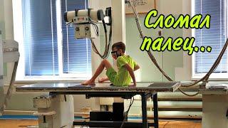 Turbo Max СЛОМАЛ ПАЛЕЦ. Не шутки.