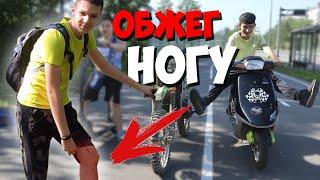 Друг ОБЛИЛСЯ горячим МАСЛОМ | Покатушка с ПОДПИСЧИКАМИ